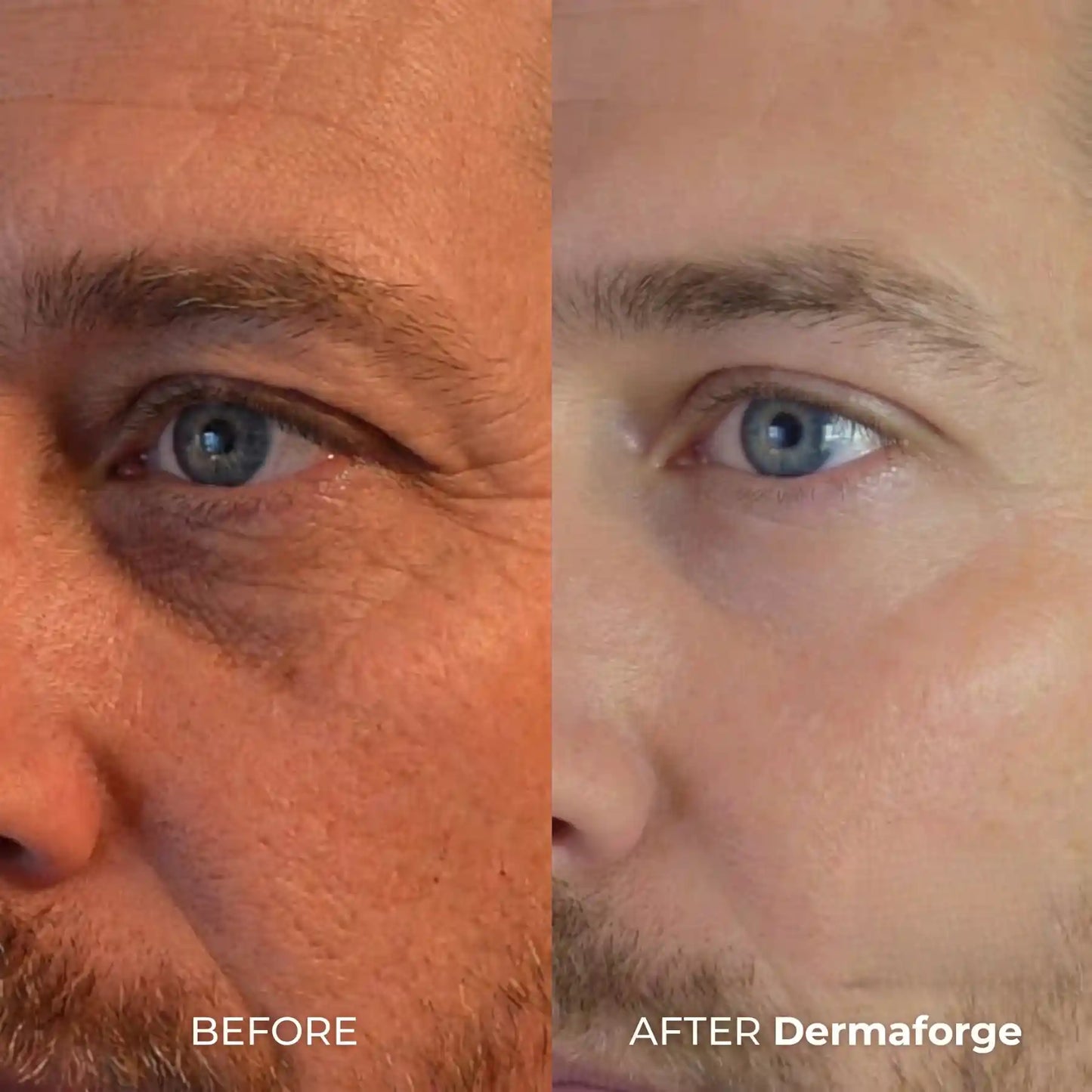 DermaForge - Advanced Men's Collagen Cream