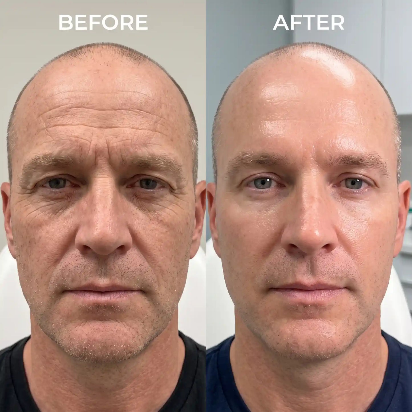 DermaForge - Advanced Men's Collagen Cream