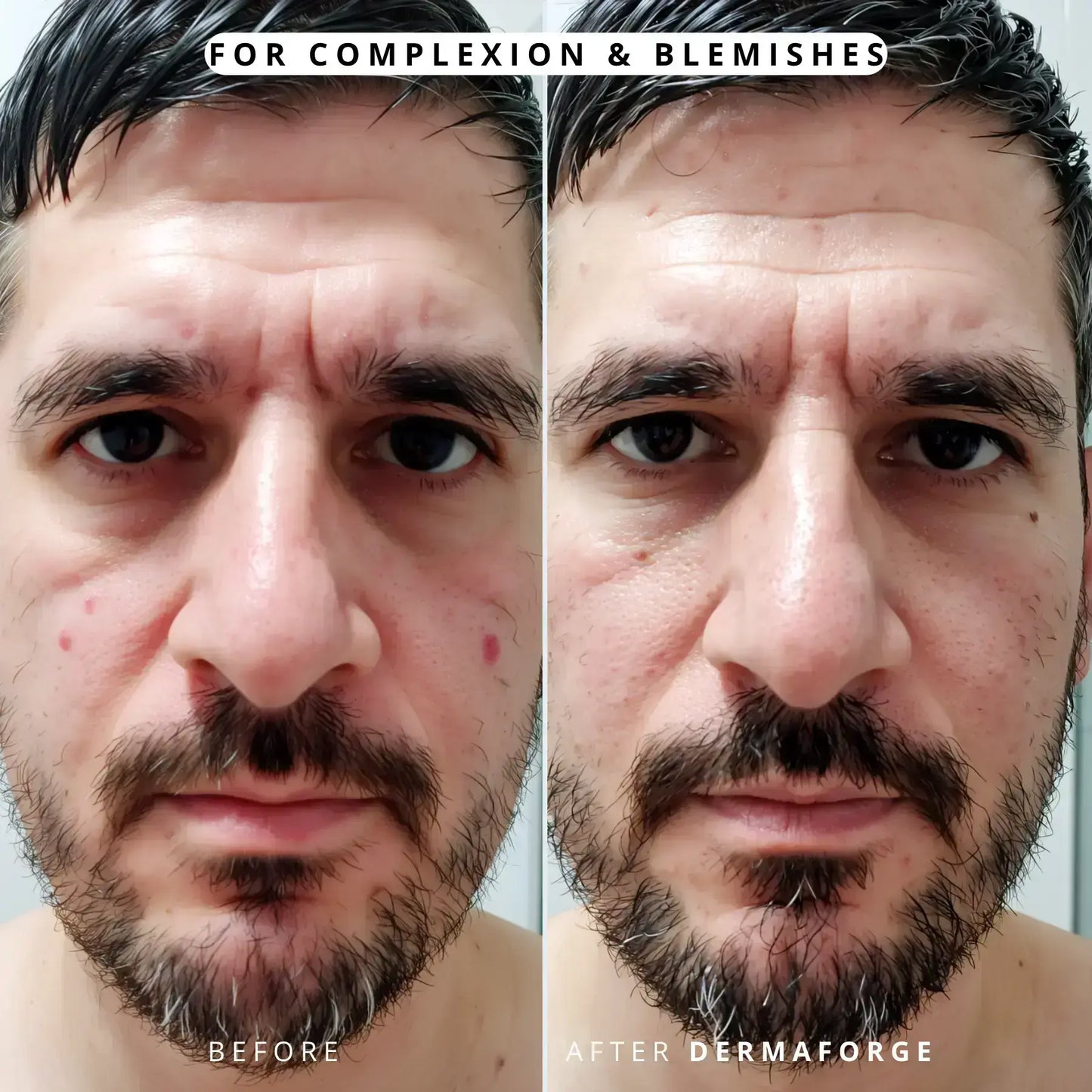DermaForge - Advanced Men's Collagen Cream