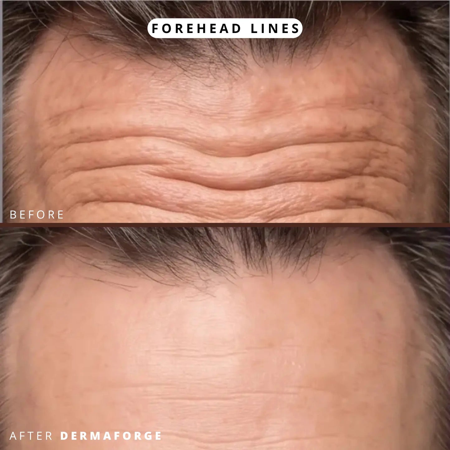 DermaForge - Advanced Men's Collagen Cream