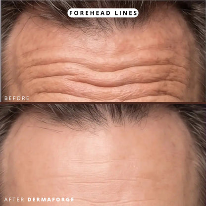 DermaForge® – Advanced Men's Collagen Cream | Anti-Wrinkle Formula